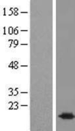 Novus Biologicals&trade;&nbsp;BUD31 Overexpression Lysate