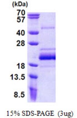 Novus Biologicals&trade;&nbsp;Recombinant Human BUD31 His Protein