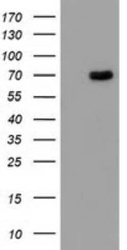 Butyrylcholinesterase/BCHE Antibody (OTI1E1), Novus Biologicals 0.1mL;