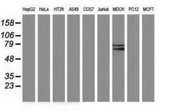 Butyrylcholinesterase/BCHE Antibody (OTI1E1), Novus Biologicals 0.1mL;