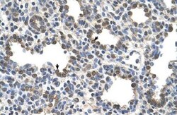 Butyrylcholinesterase/BCHE Antibody, Novus Biologicals 0.1mg; Unlabeled:Antibodies,