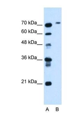 Butyrylcholinesterase/BCHE Antibody, Novus Biologicals 0.1mg; Unlabeled:Antibodies,