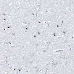 BXDC1 Antibody, Novus Biologicals 25 &mu;L; Unlabeled:Antibodies, Polyclonal