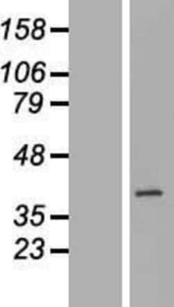 Novus Biologicals&trade;&nbsp;BXDC1 Overexpression Lysate