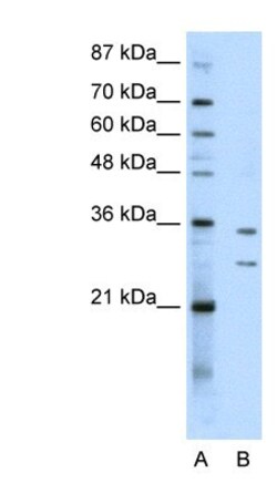 BXDC5 Antibody, Novus Biologicals 100μL; Unlabeled:Antibodies, Polyclonal
