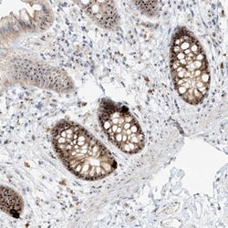 BYSL Antibody, Novus Biologicals:Antibodies:Primary Antibodies