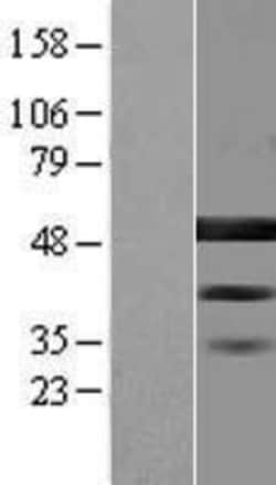 Novus Biologicals&trade;&nbsp;BZW2 Overexpression Lysate