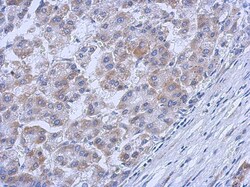 c-Abl Antibody, Novus Biologicals 0.1mL; Unlabeled:Antibodies, Polyclonal
