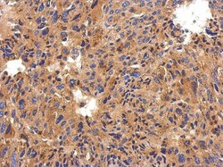 Serpin G1/C1 Inhibitor Antibody, Novus Biologicals 0.1mL; Unlabeled:Antibodies,