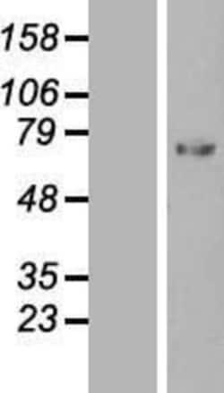 Novus Biologicals™ Serpin G1/C1 Inhibitor Overexpression Lysate