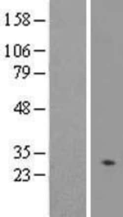 Novus Biologicals&trade;&nbsp;CABCOCO1 Overexpression Lysate