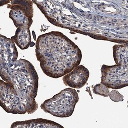 CABCOCO1 Antibody, Novus Biologicals 0.1mL; Unlabeled:Antibodies, Polyclonal