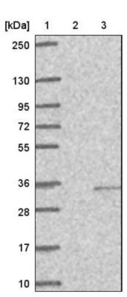 CABCOCO1 Antibody, Novus Biologicals 0.1mL; Unlabeled:Antibodies, Polyclonal
