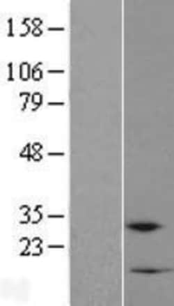 Novus Biologicals™ RPP38-DT Overexpression Lysate