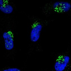 C10orf113 Antibody, Novus Biologicals:Antibodies:Primary Antibodies
