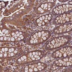 SKIDA1 Antibody, Novus Biologicals 0.1mL; Unlabeled:Antibodies, Polyclonal
