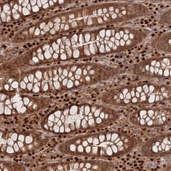 BORCS7 Antibody, Novus Biologicals 0.1mL; Unlabeled:Antibodies, Polyclonal