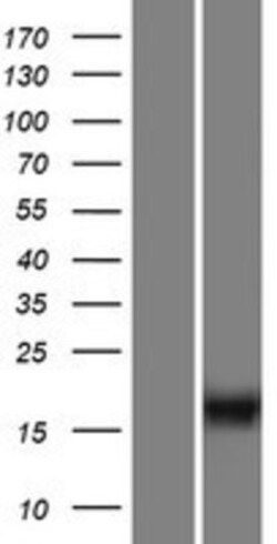 Novus Biologicals™ C10orf53 Overexpression Lysate