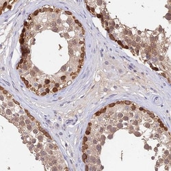 C10orf55 Antibody, Novus Biologicals 25 &mu;L; Unlabeled:Antibodies, Polyclonal