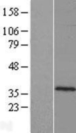 Novus Biologicals&trade;&nbsp;C10orf62 Overexpression Lysate