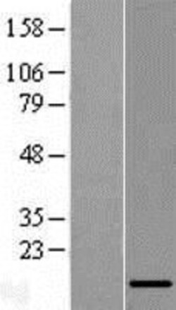Novus Biologicals&trade;&nbsp;LINC01561 Overexpression Lysate
