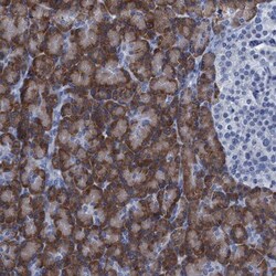 C10orf88 Antibody, Novus Biologicals 25 &mu;L; Unlabeled:Antibodies, Polyclonal