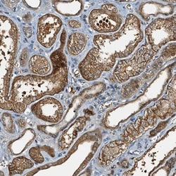 C10orf90 Antibody, Novus Biologicals:Antibodies:Primary Antibodies
