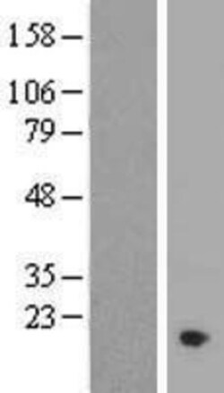 Novus Biologicals&trade;&nbsp;C11orf1 Overexpression Lysate