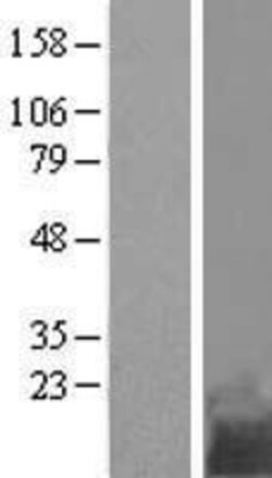 Novus Biologicals™ TMEM258 Overexpression Lysate