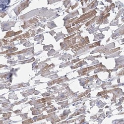 C11orf21 Antibody, Novus Biologicals:Antibodies:Primary Antibodies