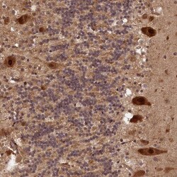 VPS51 Antibody, Novus Biologicals:Antibodies:Primary Antibodies