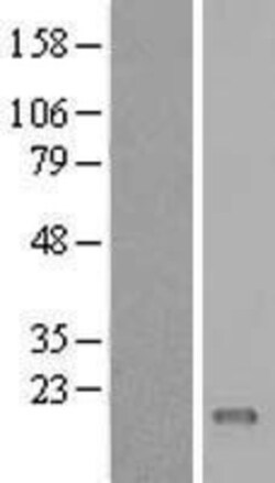 Novus Biologicals&trade;&nbsp;C11orf45 Overexpression Lysate