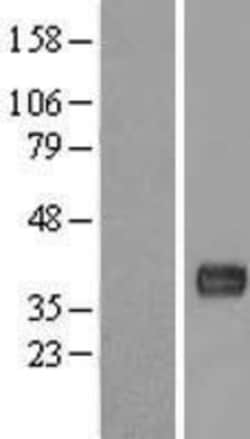 Novus Biologicals&trade;&nbsp;LBHD1 Overexpression Lysate