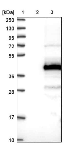 C11orf49 Antibody, Novus Biologicals:Antibodies:Primary Antibodies
