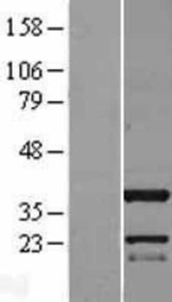 Novus Biologicals&trade;&nbsp;C11orf49 Overexpression Lysate