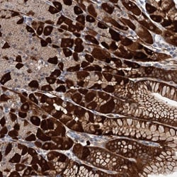 C11orf49 Antibody, Novus Biologicals:Antibodies:Primary Antibodies
