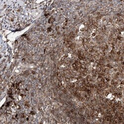 ANAPC15 Antibody, Novus Biologicals 25 &mu;L; Unlabeled:Antibodies, Polyclonal