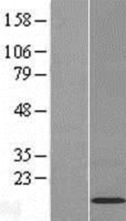 Novus Biologicals™ C11orf52 Overexpression Lysate