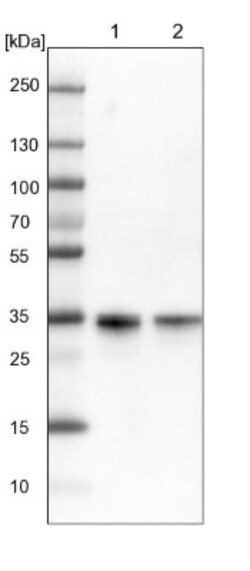 C11orf54 Antibody, Novus Biologicals 25 &mu;L | Buy Online | Novus Biologicals | Fisher Scientific