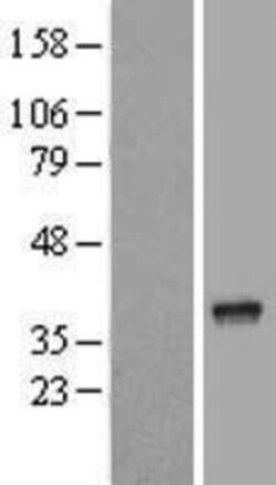 Novus Biologicals™ NKAPD1 Overexpression Lysate