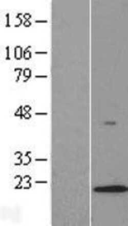 Novus Biologicals&trade;&nbsp;LAMTOR1 Overexpression Lysate