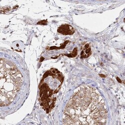 AAMDC Antibody, Novus Biologicals 25 &mu;L, Unlabeled:Antibodies, Polyclonal