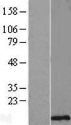 Novus Biologicals™ SMCO4 Overexpression Lysate