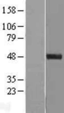 Novus Biologicals&trade;&nbsp;SPINDOC Overexpression Lysate