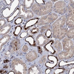 C11orf86 Antibody, Novus Biologicals:Antibodies:Primary Antibodies
