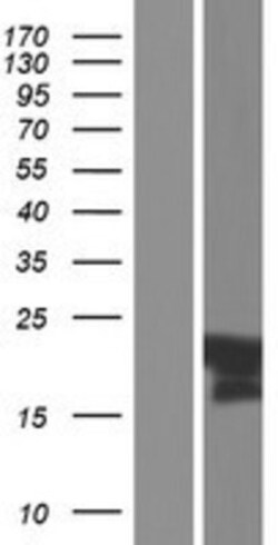 Novus Biologicals&trade;&nbsp;C11orf87 Overexpression Lysate