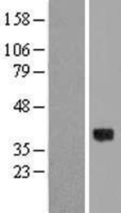 Novus Biologicals™ MYRFL Overexpression Lysate