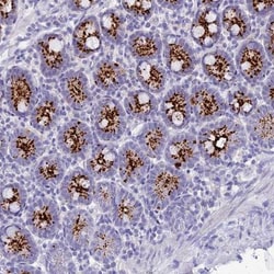 C12orf29 Antibody, Novus Biologicals:Antibodies:Primary Antibodies