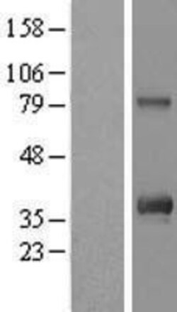 Novus Biologicals&trade;&nbsp;Custos Overexpression Lysate