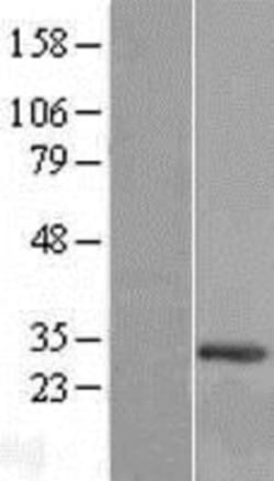 Novus Biologicals™ C12orf45 Overexpression Lysate